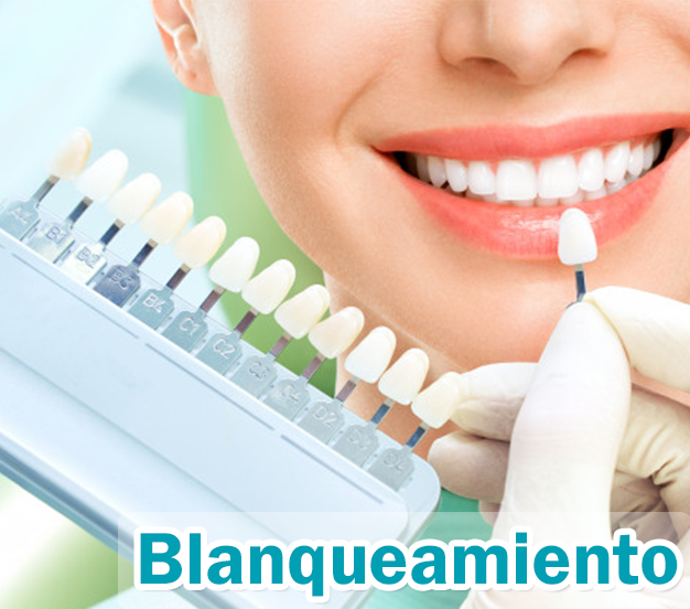 Estética Dental
